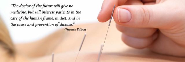 #acupunture #HealthyMillennialMom